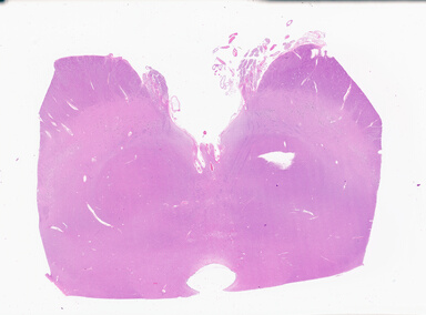 ['deident_db6f795a-a6bc-4055-a7f5-5dc9e94fe8da_69b0589b.jpg']