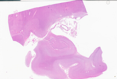 ['deident_72d4f3a6-34fd-42bf-8de6-0ba2c34ecf63_69b05870.jpg']
