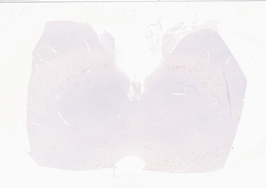 ['deident_da392cd7-a90d-485f-ad27-6fb03e9b1cf5_69b05899.jpg']