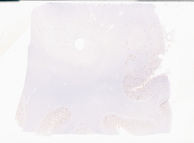 ['deident_5e534a62-7ffb-46f2-9a9a-f5e68952b6b0_69b05862.jpg']