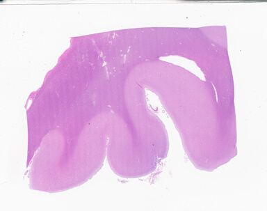 ['deident_f6457a16-1089-4221-99ac-f36af8645288_69b058a7.jpg']