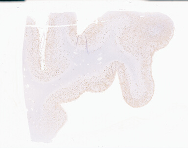 ['deident_04e19d45-bd90-4ec7-a95a-f367dcca37ff_69b05847.jpg']