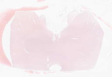 ['deident_ad25a1f7-088c-4b4f-ac03-37b9d4126289_69b05887.jpg']