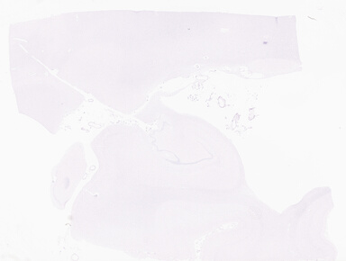 ['deident_fab66ab8-49cf-4f93-ab1a-40e5fcfcccfd_69b058ab.jpg']
