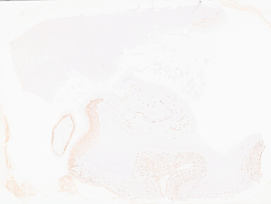 ['deident_dfd74063-e1dc-4362-bf1d-bec6cb366c08_69b0589d.jpg']
