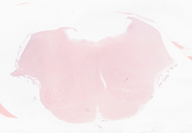 ['deident_2bb6707e-36a3-448c-8fc3-cfb10135384d_69b05854.jpg']