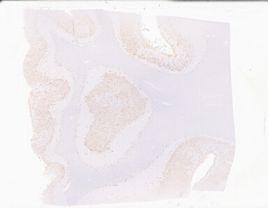 ['deident_ad742498-9b3d-4a2f-aa27-c47f1d2954e0_69b0588a.jpg']