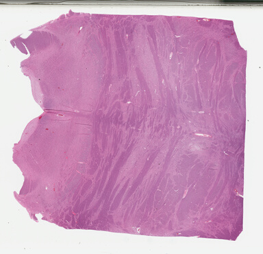 ['deident_b3dca08f-ec8d-4561-9880-7e4411f0c4a2_695fcdda.jpg']