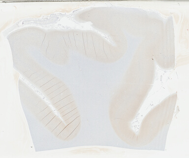 ['deident_0a4aa437-0d1c-4de2-a5ff-b0a6fbd10453_695fcd8b.jpg']