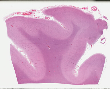 ['deident_4c085a82-ab14-4ac8-8973-25f008a33de3_695fcdae.jpg']