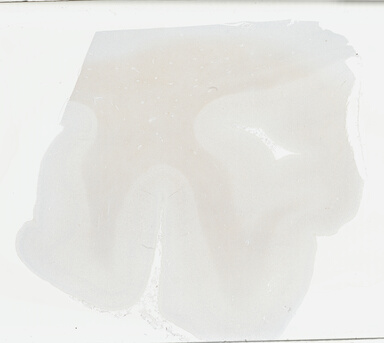 ['deident_b44c1b5c-8407-44ee-a29d-80e36f278f4a_695fcddd.jpg']