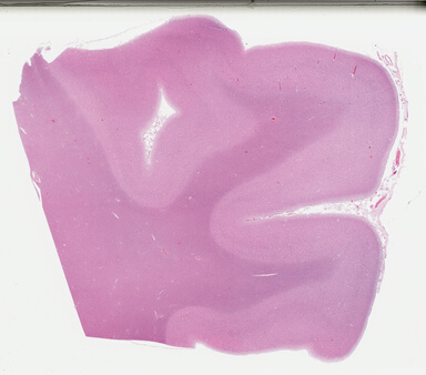 ['deident_184db036-0212-44f0-b63d-169c71523905_695fcd8f.jpg']
