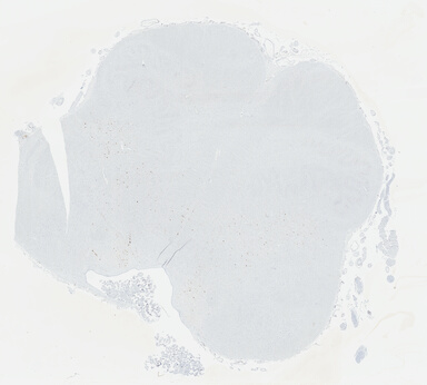 ['deident_95c16932-eaeb-48c2-984e-d35a97994cdf_695fcdc4.jpg']