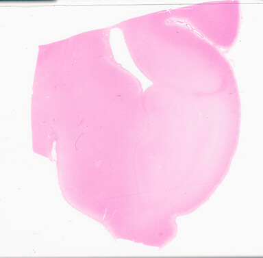 ['deident_1adf6cef-ab23-42e6-aa82-97b7c23b3fea_695fcd90.jpg']