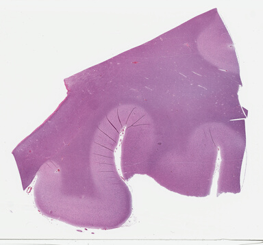 ['deident_29c16bd7-0d8d-41e4-a529-d03af637cf70_695fcd9b.jpg']
