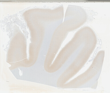 ['deident_029f4dd3-380e-42df-bc04-abe48791a15b_695fcd88.jpg']
