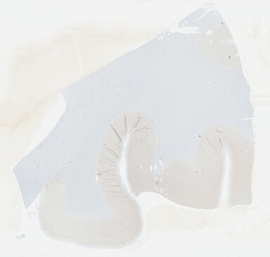 ['deident_227b1f7d-d9f1-4c5e-aa6c-371445904354_695fcd96.jpg']