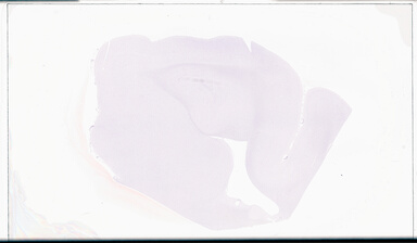 ['deident_9e4ec730-d32c-4641-b50f-a945f30d3477_695fcdca.jpg']
