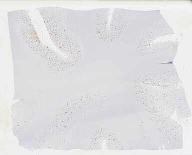 ['deident_8cf1a4b5-b80b-483e-9e74-f6004242f7ad_69b042e8.jpg']