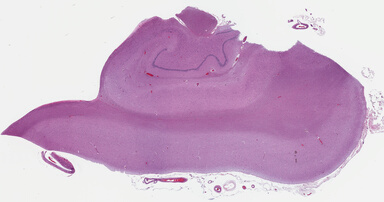['deident_ed6d3854-e4eb-438c-ac9a-fac4261d3d5e_69b04303.jpg']