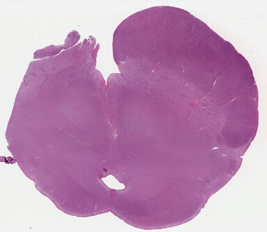 ['deident_142cea21-81e1-48ad-b65a-2ab0f43857dc_69b042ca.jpg']