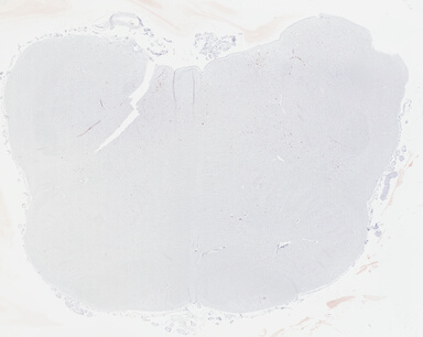 ['deident_8ba16a0d-8e3b-46a3-a6a2-67b4e162c396_69b042e7.jpg']