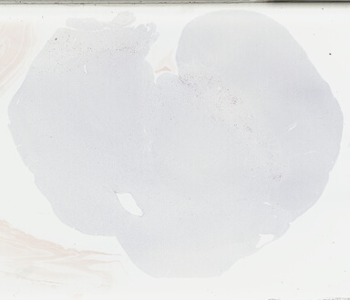 ['deident_3c1cad3d-4188-485e-b6bd-cf888a8bdbd4_69b042cf.jpg']