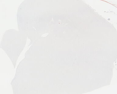 ['deident_ed26b127-c406-4e2a-8fda-9ef64cba68af_69b042ff.jpg']