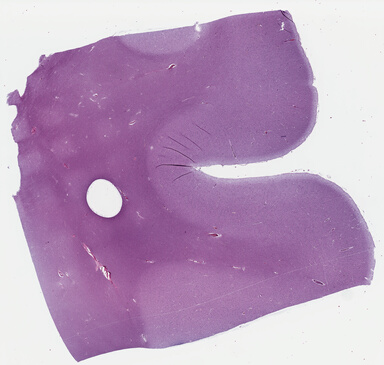 ['deident_6f34d73e-31a2-40ae-a4ff-ae54cfab766e_69b042dd.jpg']