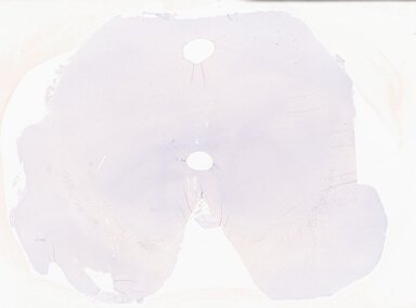 ['deident_1777bca6-a575-4808-9442-86ab677bef51_69b02bd0.jpg']