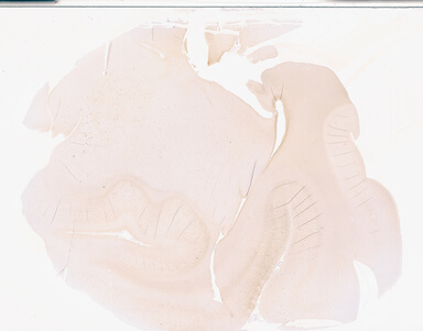 ['deident_05815c91-e1ba-4f58-b5f4-6f3dafe3a24e_69b02bbf.jpg']