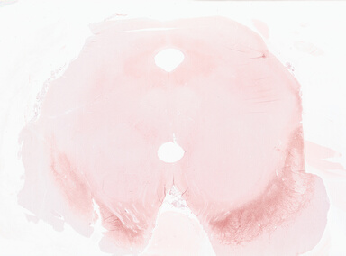 ['deident_a9e94756-644a-43f3-8140-4568d87dd619_69b02c11.jpg']