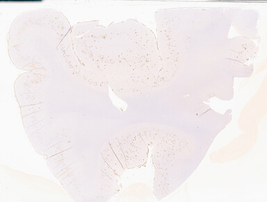 ['deident_1c083ee1-19b5-4eee-92c6-e497d1bf7f01_69b02bd3.jpg']