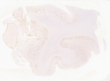 ['deident_cd933c8a-400f-4dd1-9f51-69b8c443bfad_69b02c23.jpg']
