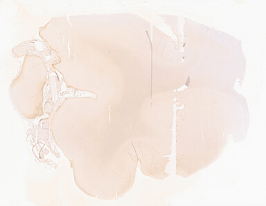 ['deident_4b19e14b-bcf9-498f-a64f-b4853c5b0ed0_69b02beb.jpg']