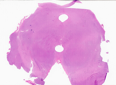 ['deident_a56f4f92-618b-4c49-8a54-ee29ee8d2a8a_69b02c0c.jpg']