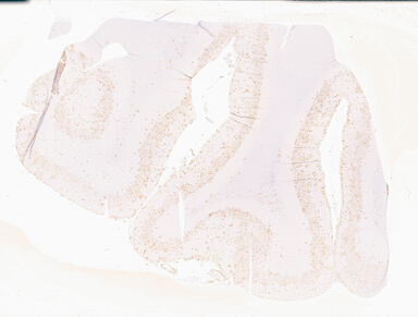 ['deident_e8eaac44-8a4e-400d-8e32-8cfe1e1114d2_69b02c2e.jpg']