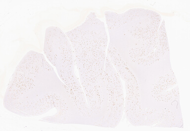 ['deident_6e985c65-21e4-4462-9baa-da695067ac2f_69d94333.jpg']