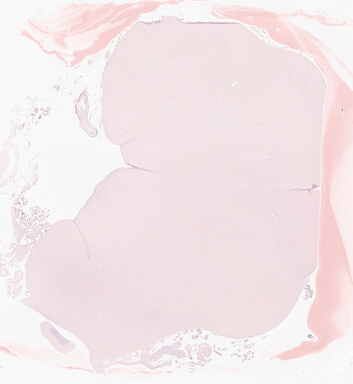 ['deident_baeab7ab-b036-4422-8d3b-f466dc9f9bdc_69d94349.jpg']