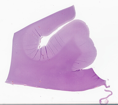 ['deident_51c93a4a-4d30-4be6-bc21-9bdfe4ed3505_69d94326.jpg']