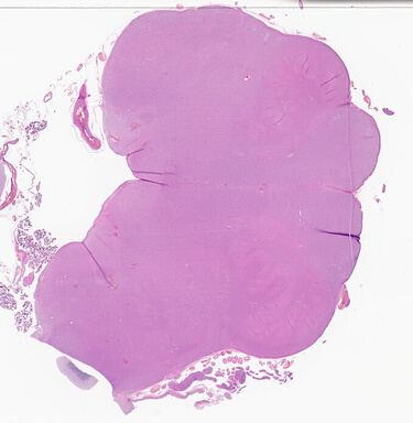 ['deident_ff321ae4-f283-4da0-9526-1aa9937030e1_69d94374.jpg']