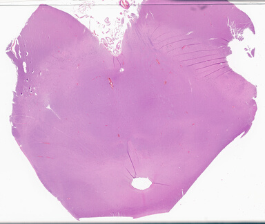 ['deident_e25c3f6a-6dec-4c9a-afda-71c2dc0bdf97_69d9435b.jpg']