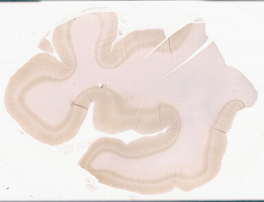 ['deident_fe5ea438-2e52-468f-a32e-0725c27be460_69d94371.jpg']