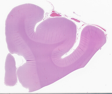 ['deident_aa6f7547-1645-4443-88ab-0b9ef1de656c_69d94347.jpg']