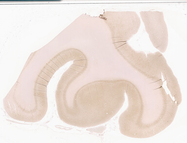 ['deident_99a30460-00bc-4af6-a236-950d18d0977e_69d94341.jpg']