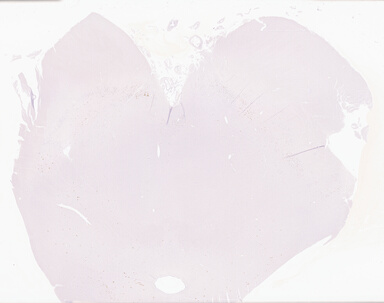 ['deident_5d091428-57af-4417-b3b6-9d8ac46c9583_69d9432c.jpg']