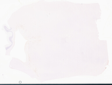 ['deident_d9d42952-36c4-4cd5-b89e-22e1fa006a9b_69d94358.jpg']