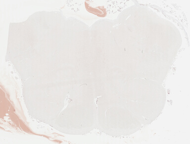 ['deident_005e4372-4864-498e-b7ad-52fbf4eb96c6_695fcfa7.jpg']