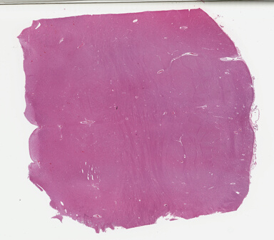 ['deident_39abbd5c-1880-4680-b0d1-1cedebb2d79b_695fcfb1.jpg']