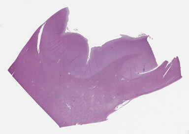 ['deident_b2cfb896-351e-4c91-81a7-3eb927f6710e_695fcfcb.jpg']